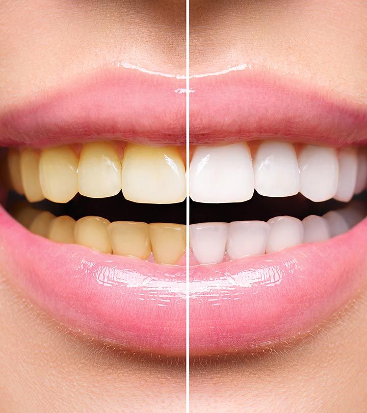 Activated Charcoal Teeth Whitening Powder